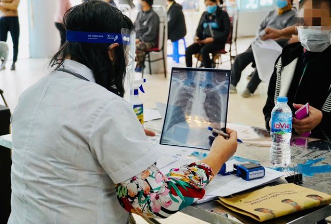 Vì mục tiêu “Việt Nam chấm dứt bệnh lao vào năm 2030”